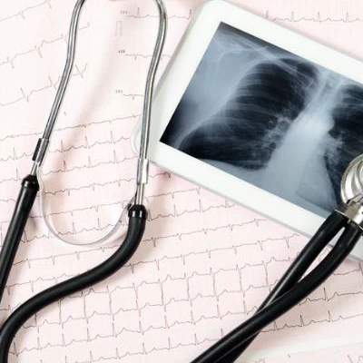 Radiographie des poumons